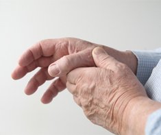 Arthritis
